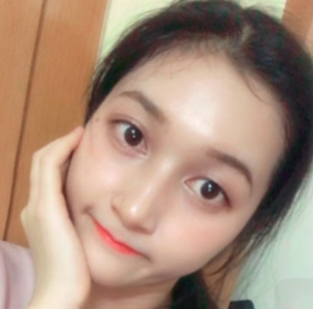 上海時(shí)光整形醫(yī)院做面部玻尿酸注射效果怎么樣？