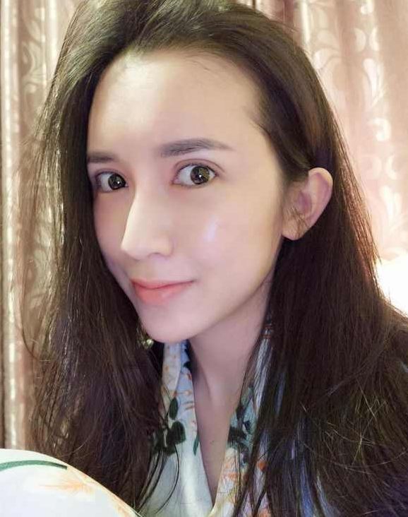 上海時光整形醫(yī)院張晶醫(yī)生做開眼角怎么樣？附真實效果圖