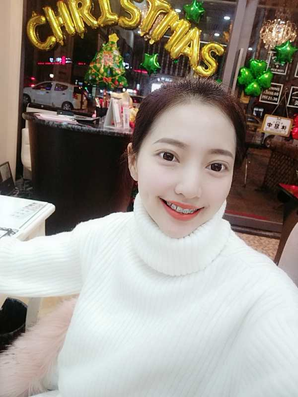 巴中華醫(yī)口腔醫(yī)院做牙齒矯正效果好嗎？附母汶靈醫(yī)生牙齒矯正案例效果圖