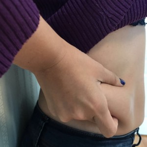 蚌埠韓美美萊整形醫(yī)生張濤做水動力吸脂怎么樣？附吸脂案例效果圖