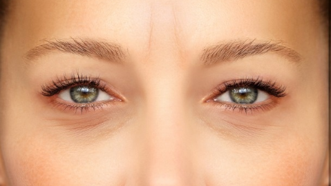 割眼袋要注意什么？