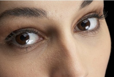 隆鼻假體能保持幾年？