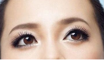 激光去黑眼圈多少錢(qián)？激光去黑眼圈效果好嗎？