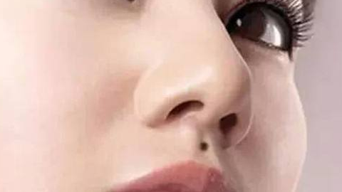 綜合隆鼻價(jià)格需要多少錢？?jī)r(jià)格貴嗎？