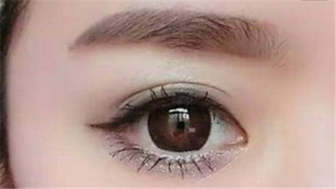 韓式開內(nèi)眼角多少錢？價錢貴不貴？