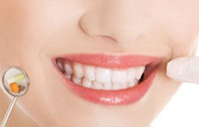 美容冠的危害有哪些？可以矯正齙牙嗎？