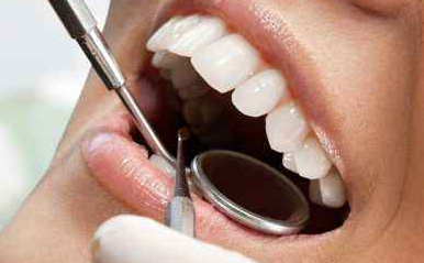 超聲波洗牙一次多少錢？?jī)r(jià)錢怎么樣？