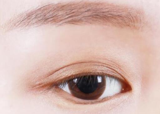 雙眼皮的寬度怎么選擇，多少mm合適？