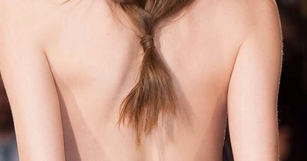 背部吸脂包括肩膀嗎？背部吸脂需要住院嗎？