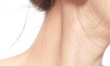 頸紋太深怎么辦?去除頸紋一般需要多少錢？