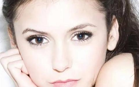 全切雙眼皮會(huì)留疤嗎？全切雙眼皮的優(yōu)勢(shì)有哪些？