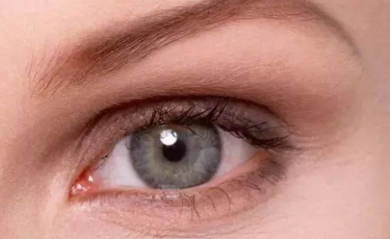 埋線雙眼皮能保持幾年？