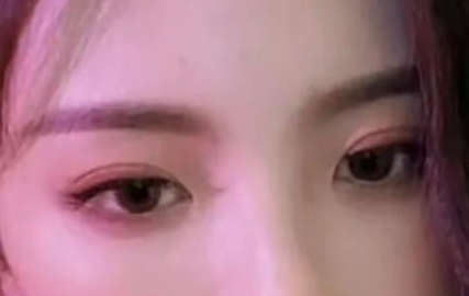 割雙眼皮會有疤痕嗎？