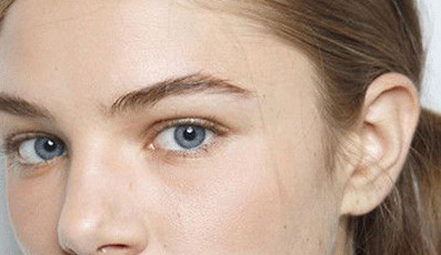 單眼皮割雙眼皮會(huì)留疤嗎？