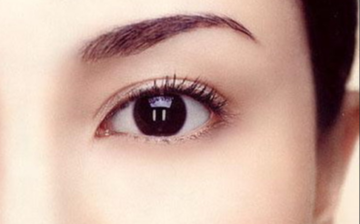 韓式開眼角多久能好？韓式開眼角多久能消腫？