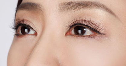 韓式開(kāi)眼角需要多久?韓式無(wú)痕開(kāi)眼角需要多少錢？