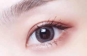 開內(nèi)眼角大概需要多久恢復(fù)？