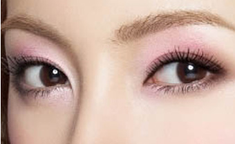 開內(nèi)眼角疤痕怎么消除？