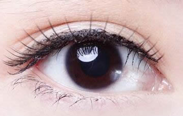 開(kāi)內(nèi)眼角都會(huì)回縮嗎？開(kāi)內(nèi)眼角的優(yōu)勢(shì)有哪些？