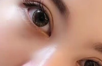 開眼角有沒有風(fēng)險？開眼角有沒有副作用？