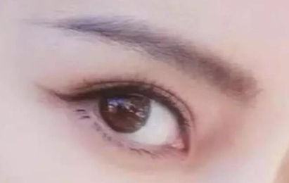 外眼角開(kāi)大會(huì)留疤嗎？