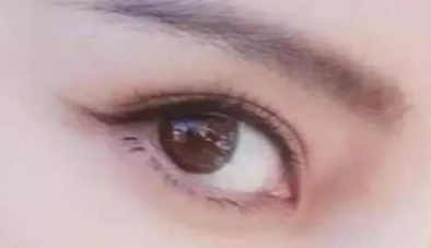 開眼角需要多久才能恢復(fù)？