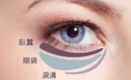 激光能祛除眼袋嗎？
