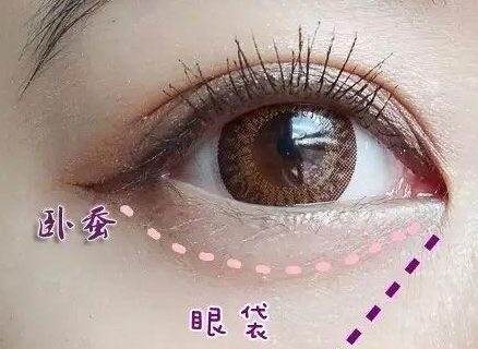 激光消除眼袋怎么樣？激光溶脂去眼袋多少錢？