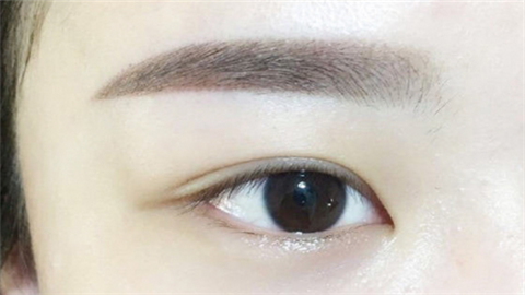 開眼角哪個醫(yī)院做的好？2022開眼角整形醫(yī)院排名前十