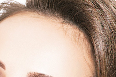 武漢植發(fā)整形醫(yī)院排名更新！實力口碑醫(yī)院推薦！