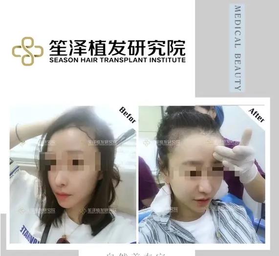 長沙笙澤植發(fā)研究院