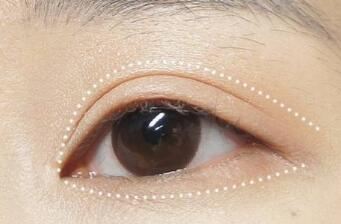 煙臺(tái)雙眼皮修復(fù)整形醫(yī)院哪幾家技術(shù)好？這10家醫(yī)院不容錯(cuò)過(guò)！