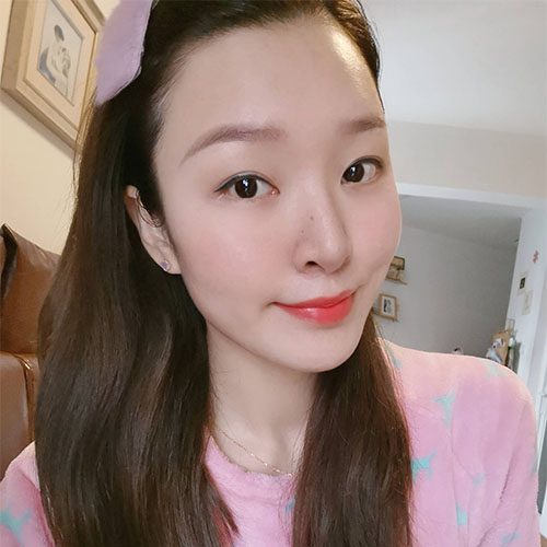 熱拉提手術(shù)效果圖3