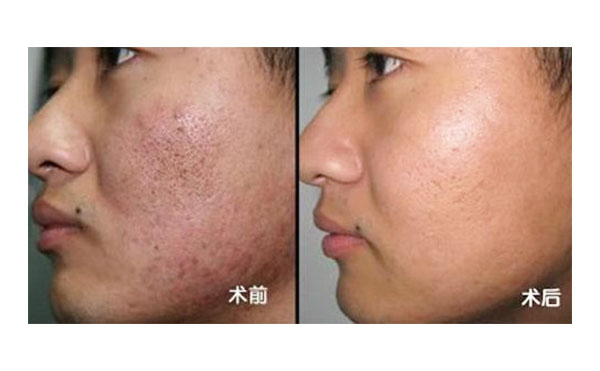 黑臉娃娃有風(fēng)險嗎？