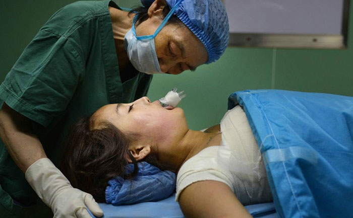 假體隆胸效果自然嗎？能維持多久？