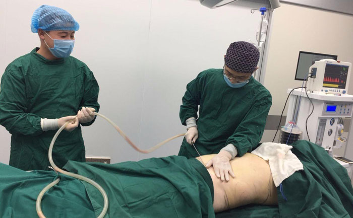 吸脂提臀線是怎么樣的？吸脂提臀多少錢？