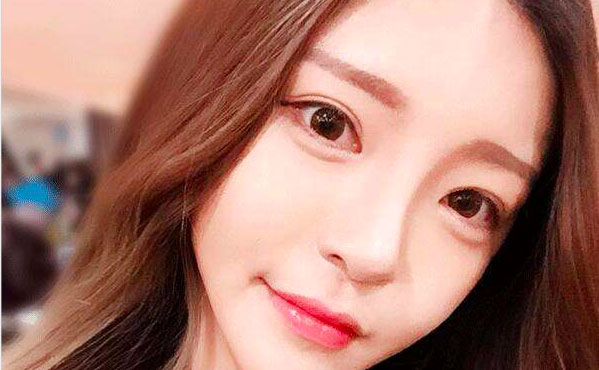 韓式開(kāi)眼角的費(fèi)用是多少？