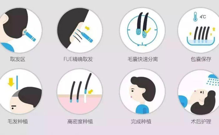 體毛種植的方法有哪些？