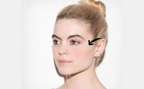 玻尿酸豐蘋果肌怎么樣？