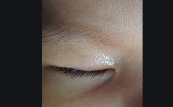 睫毛少是什么原因?睫毛少又短怎么辦?