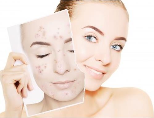 面部提拉緊致繃帶有效果嗎？