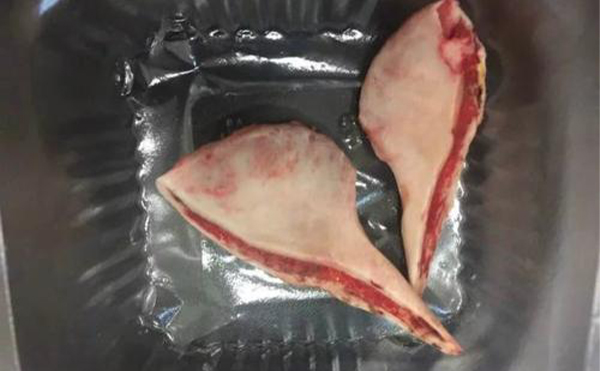 濟南海峽整形：下頜角整形術(shù)后就該這么做