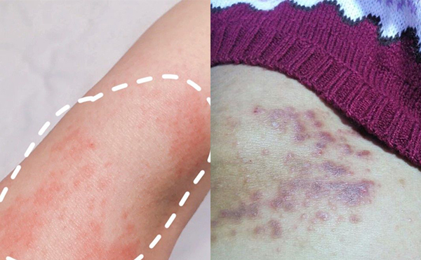 脫毛膏脫毛的效果怎么樣?