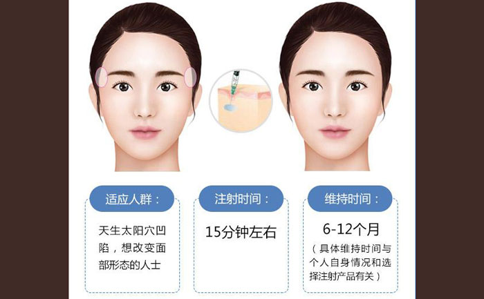 玻尿酸豐太陽(yáng)穴一般幾支？