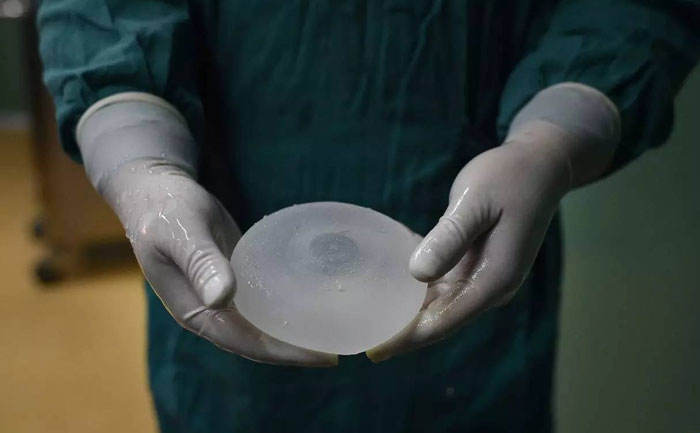 假體隆胸效果自然嗎？能維持多久？