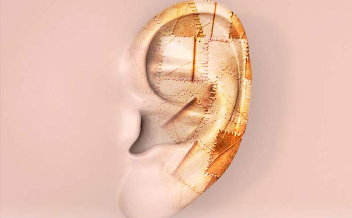 耳再造手術(shù)對(duì)軟骨有影響嗎？