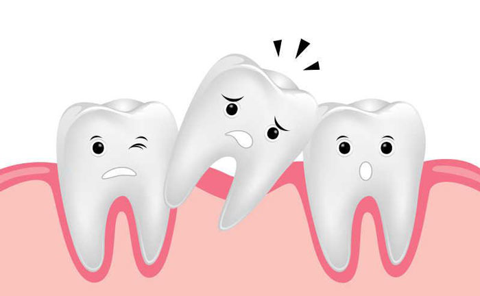 牙齒松動還能恢復(fù)嗎？