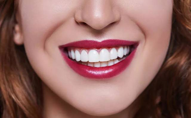 牙齒貼面怎么做？