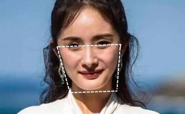 下頜角整形手術(shù)后皮膚會(huì)松弛嗎?