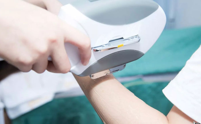 手臂脫毛多少錢？手臂脫毛幾次干凈？